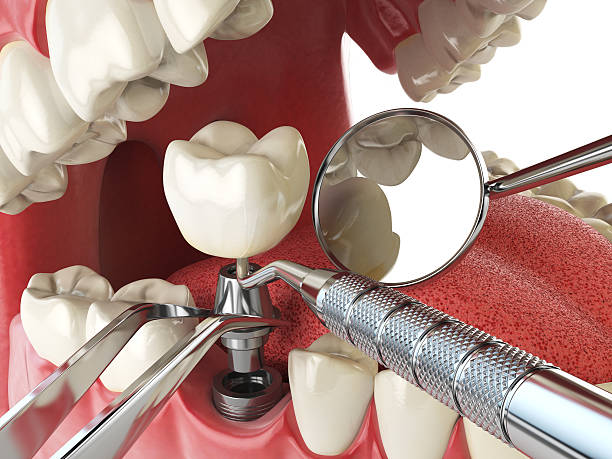 Best Urgent Care for Lost Fillings or Crowns in Vernon, WI