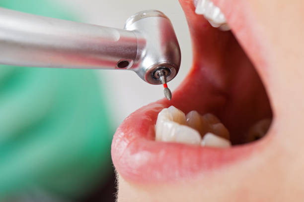 Best Emergency Gum Treatment in Vernon, WI